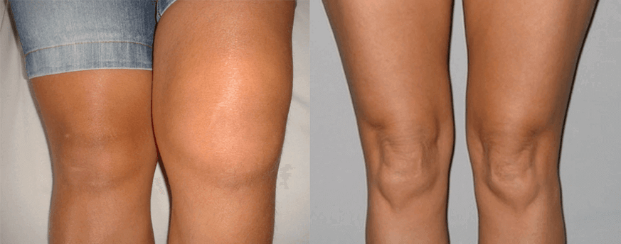 Zkušenosti s používáním kapslí s konopným olejem před a po použití od Evy